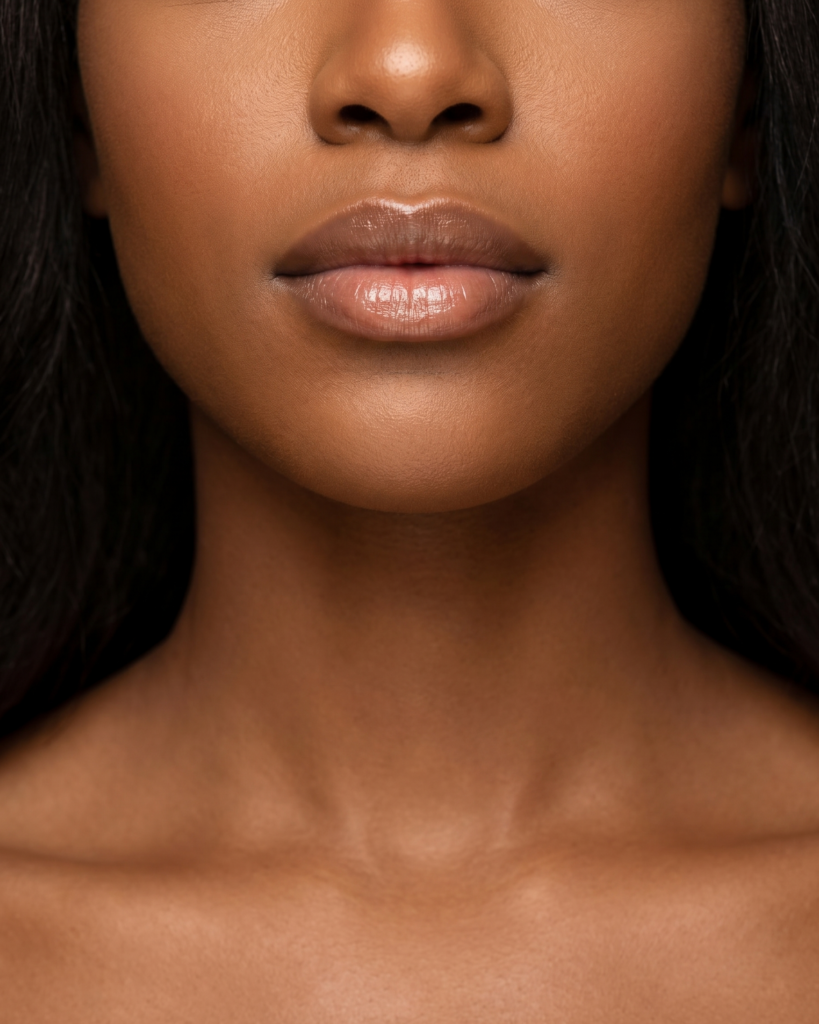 Lip surgery result at Colores Cosmetic Surgery in Hollywood, FL